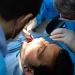 Emergency Tooth Extraction in Dubai: What to Do When You’re in Severe Pain?