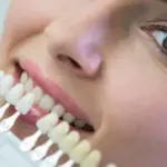 Porcelain Veneers vs. Composite Veneers: A Dubai Cosmetic Dentist’s Honest Comparison